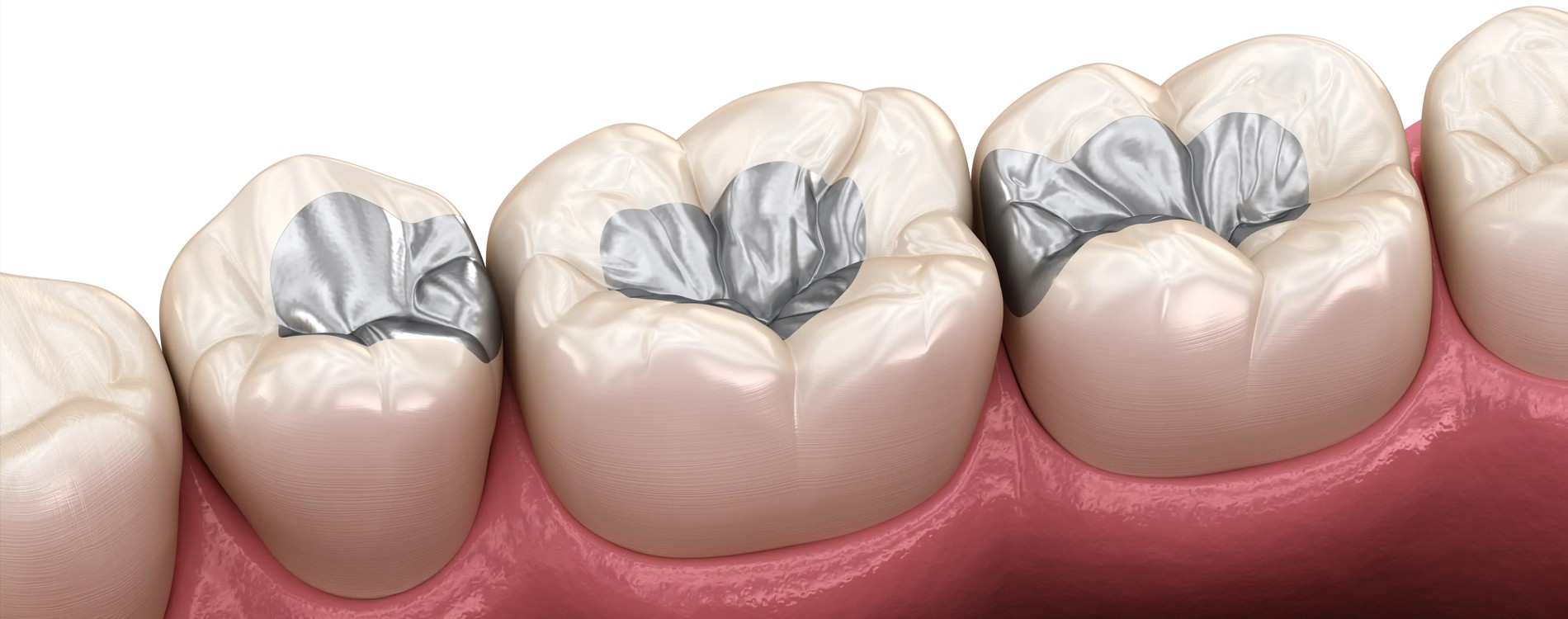 RAINBOW DENTAL CARE