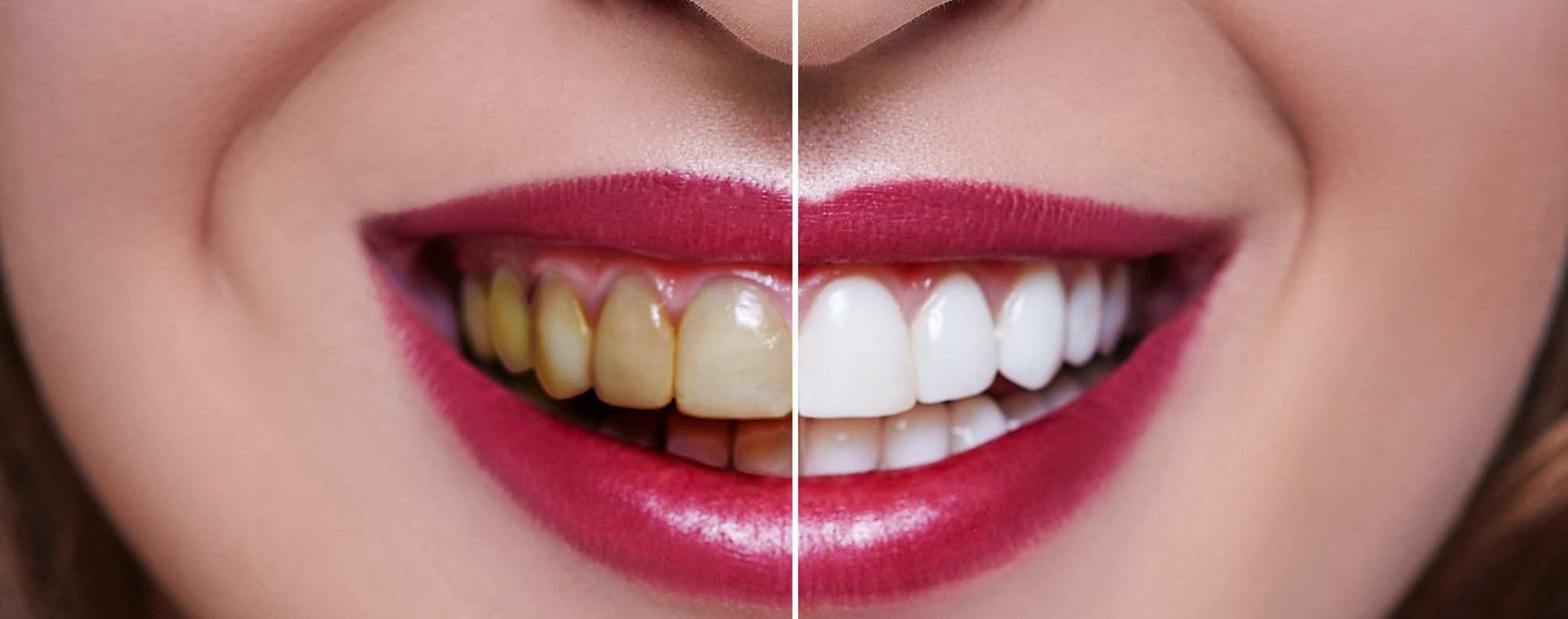 RAINBOW DENTAL CARE